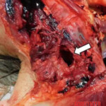 66-year-old man commits suicide with power drill