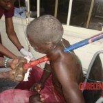 Bricklayer impaled by hammer in freak accident