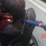 Bricklayer impaled by hammer in freak accident