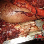 Farmer completely crushed by agricultural machinery