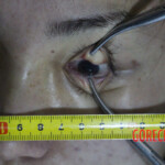 Initial examination of hanged Chinese woman