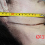Initial examination of hanged Chinese woman