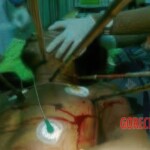 Victims of Papuan tribal wars