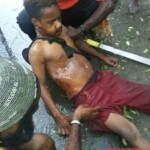Victims of Papuan tribal wars
