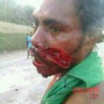 Victims of Papuan tribal wars