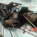 Victims of Papuan tribal wars