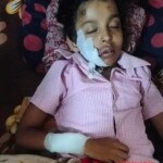 8-year-old girl attacked by stray cow