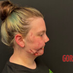 Pitbull mauls woman after she suffers seizure