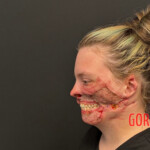 Pitbull mauls woman after she suffers seizure