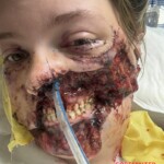 Pitbull mauls woman after she suffers seizure
