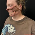 Pitbull mauls woman after she suffers seizure