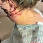 Pitbull mauls woman after she suffers seizure