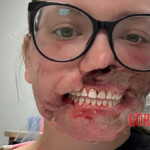 Pitbull mauls woman after she suffers seizure