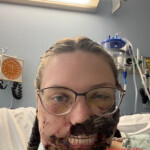 Pitbull mauls woman after she suffers seizure
