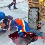 Worker's thigh crushed by heavy machinery