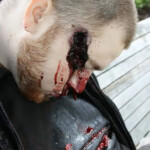 Young man shot himself in head on park bench