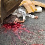 16-year-old motorcycle passenger suffered devastating head injuries