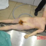 Autopsy of stabbed Chinese woman