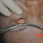 Autopsy of stabbed Chinese woman