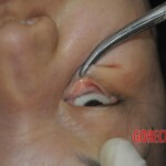 Autopsy of stabbed Chinese woman