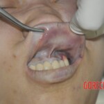 Autopsy of stabbed Chinese woman