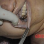 Autopsy of stabbed Chinese woman