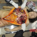 Autopsy of stabbed Chinese woman