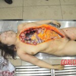 Autopsy of stabbed Chinese woman