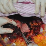 Autopsy of stabbed Chinese woman