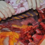 Autopsy of stabbed Chinese woman