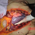 Autopsy of stabbed Chinese woman