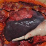 Autopsy of stabbed Chinese woman