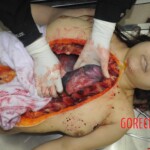 Autopsy of stabbed Chinese woman
