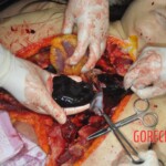 Autopsy of stabbed Chinese woman