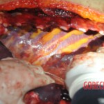 Autopsy of stabbed Chinese woman