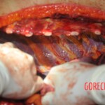 Autopsy of stabbed Chinese woman