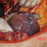Autopsy of stabbed Chinese woman
