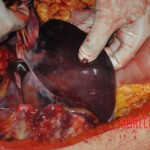 Autopsy of stabbed Chinese woman