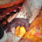 Autopsy of stabbed Chinese woman