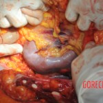 Autopsy of stabbed Chinese woman