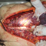 Autopsy of stabbed Chinese woman