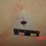 Autopsy of stabbed Chinese woman