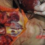 Autopsy of stabbed Chinese woman
