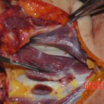 Autopsy of stabbed Chinese woman