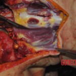 Autopsy of stabbed Chinese woman
