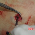 Autopsy of stabbed Chinese woman