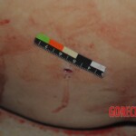 Autopsy of stabbed Chinese woman