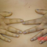 Autopsy of stabbed Chinese woman