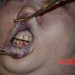 Chinese woman in morgue