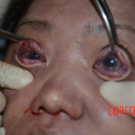 Chinese woman in morgue